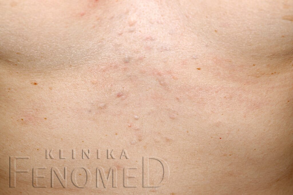 Zaskórniki zamknięte