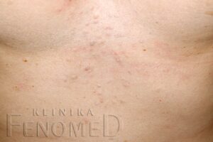 Zaskórniki zamknięte