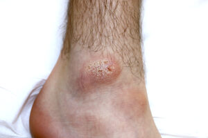 Uszkodzenie mechaniczne